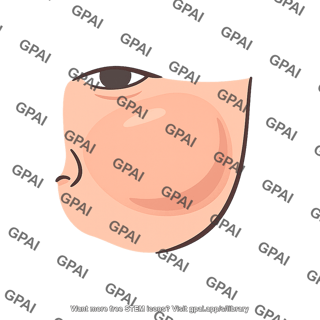 Cheek external