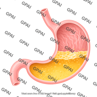 Stomach with gastric juices 01