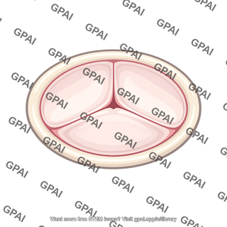 Tricuspid valve