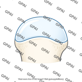 Articular surface
