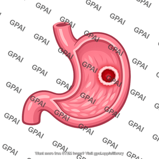Stomach ulcerated