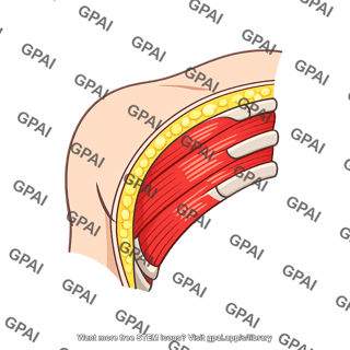Right anterior chest wall