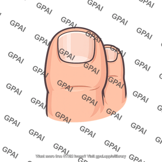 Hallux