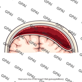 Subdural space hemorrhagic