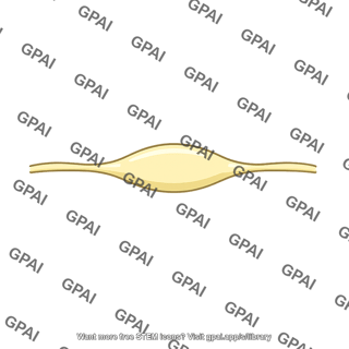 Vestibular ganglion