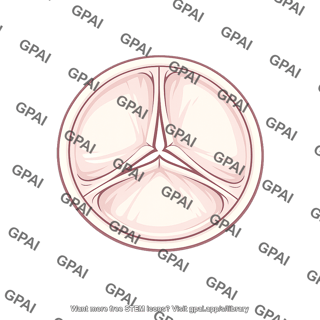 Tricuspid valve
