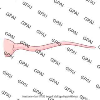 Uterine tube tapered variant