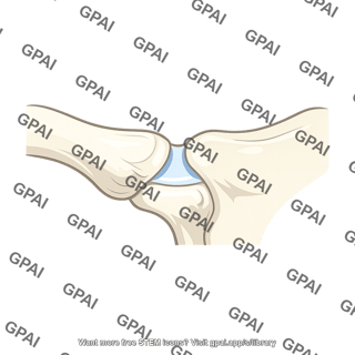 Right sternoclavicular joint