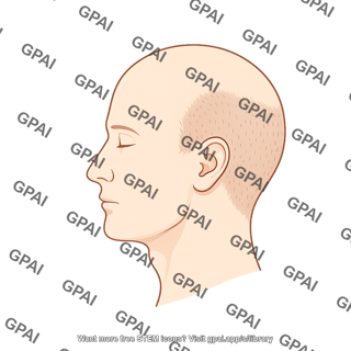 Male balding stage 0 lateral