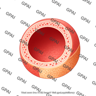 Artery cross section