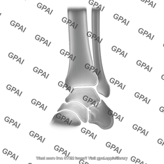 Radiograph ankle