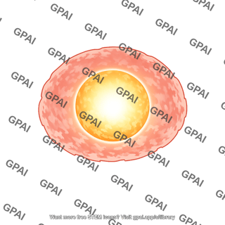 Reduced hydrogen envelope