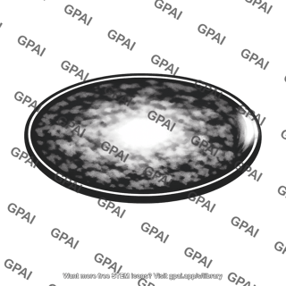 Accretion disk reconstructed negative image