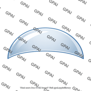 Spherical surface section