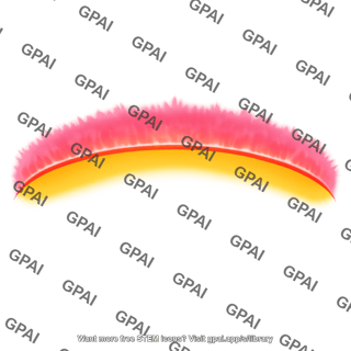 Chromosphere