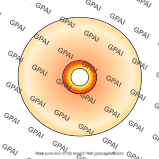 Hydrogen helium envelope