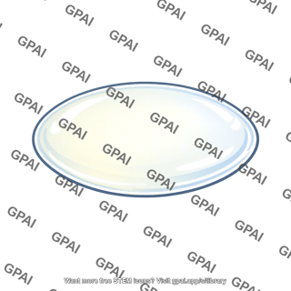 Eye lens