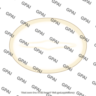 Bar galaxy structure