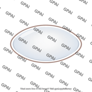 Cataract eye lens