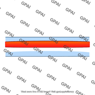 Warm inversion layer
