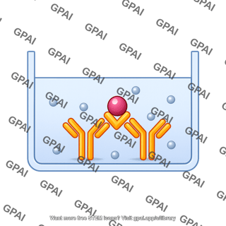 Sandwich elisa 2. antigen binds to capture antibody