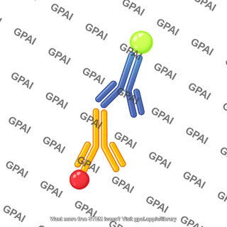 Western blot reaction fluorescence indirect
