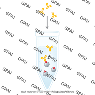 Immunoprecipitation with magnetic beads step 1 add antibody