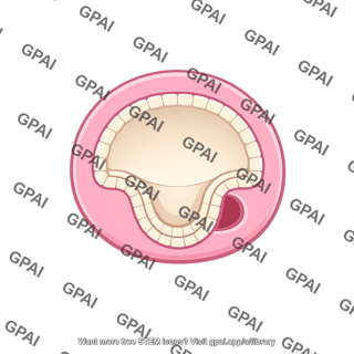 Gastrula cross section