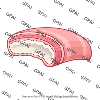 Colon wall
