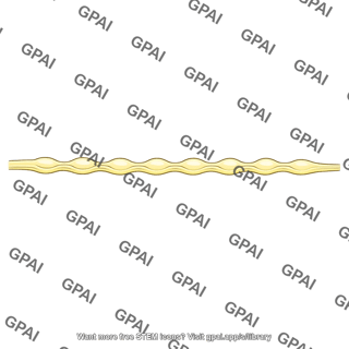 Ganglionated nerve cord