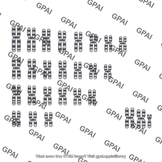 Human karyotype klinefelter syndrome