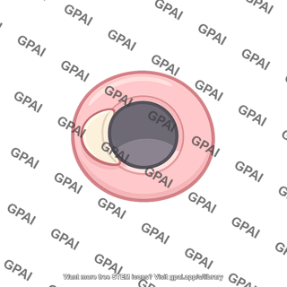Valved tissue pore