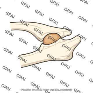 Jaw hinge dentary squamosal