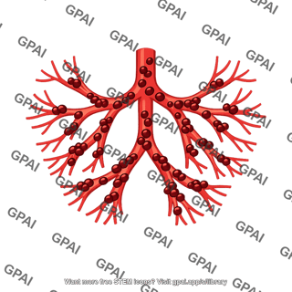 Disseminated intravascular coagulation