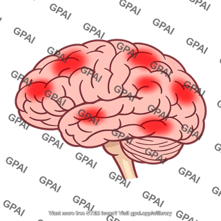 Encephalitis