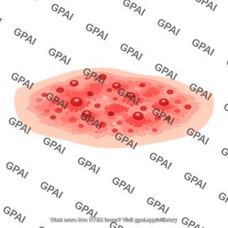 Skin rash