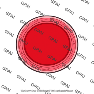 Blood vessel vasodilated