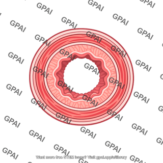 Digestive tract wall