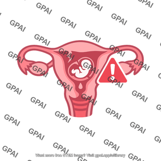 Spontaneous abortion