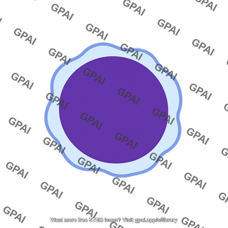 Lymphoma cell