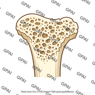 Bone demineralized