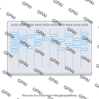 Gel electrophoresis