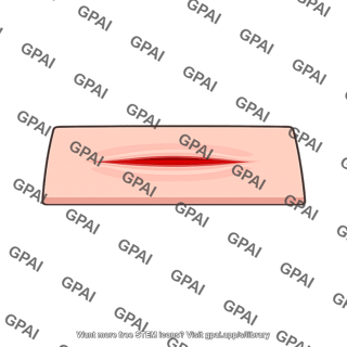 Skin incision