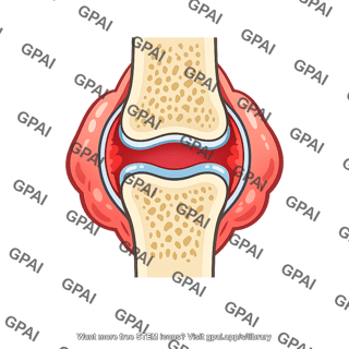 Inflamed joint
