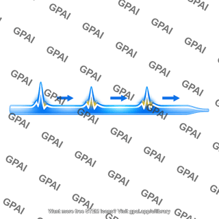 Propagating action potential