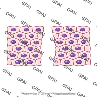 Epithelial cells