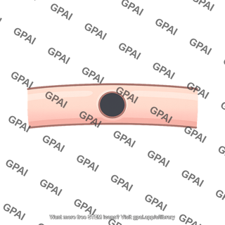 Capillary pore