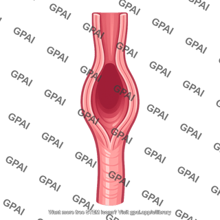 Esophagus open