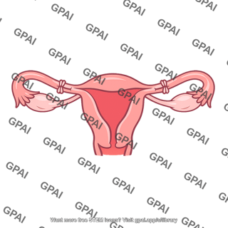 Tubal ligation