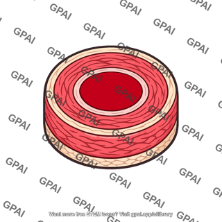 Artery